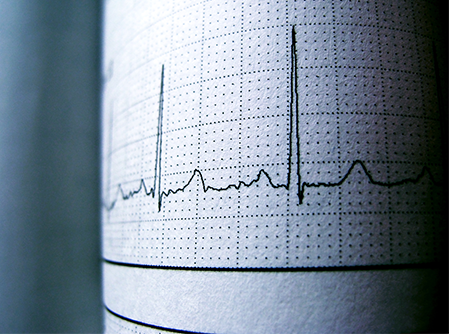 Avaliação de Marcapasso Gastroenterologia